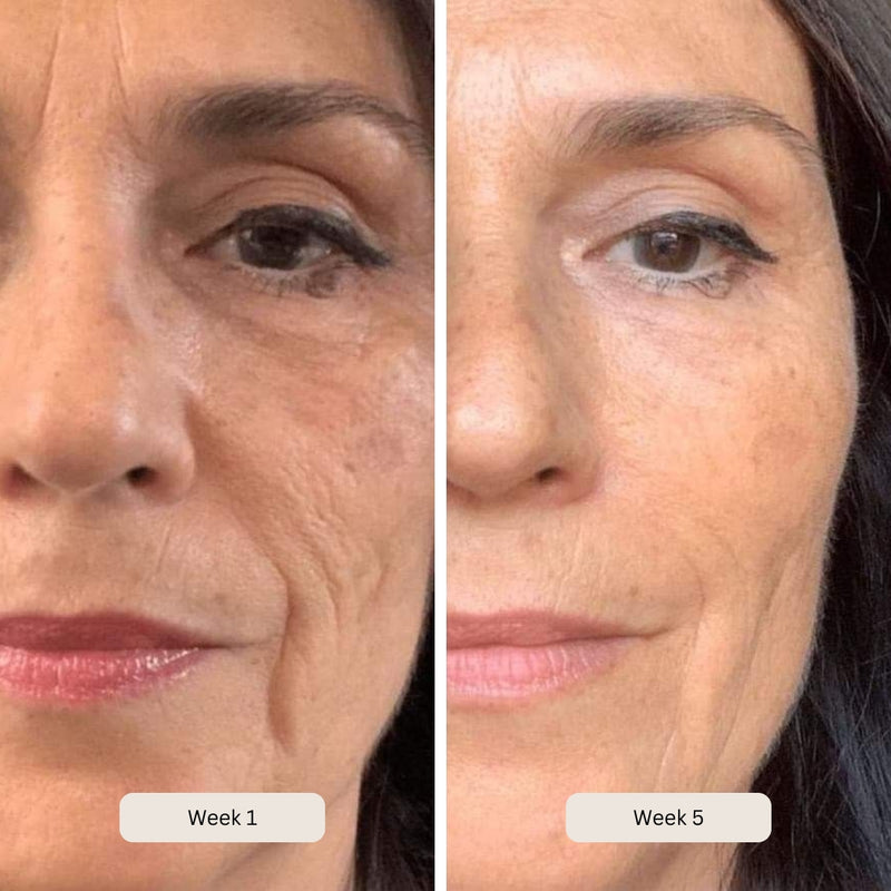 Wrinkle reduction
