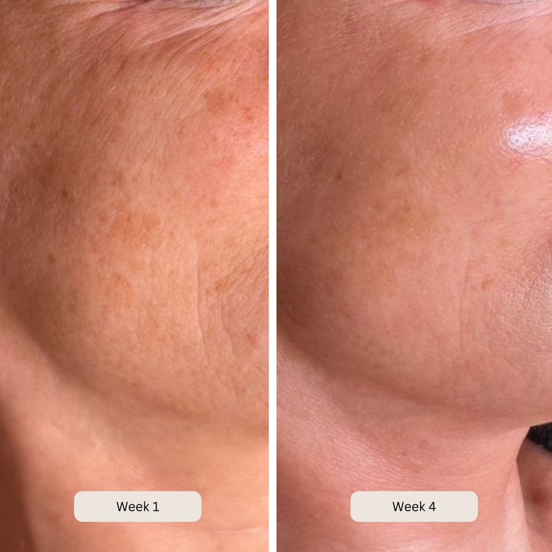 Reduces age spots